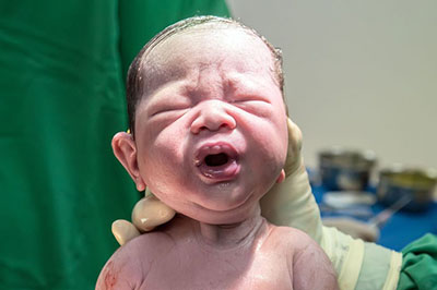 تصویر یک نوزاد تازه به دنیا آمده در دستان پزشک با دستکشهای لاتکس