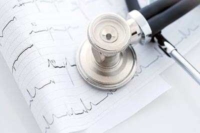 یک گوشی پزشکی بر روی کاغذ نوار قلب