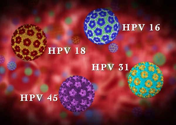 چهار نوع از ویروس‌های اچ پی وی که کروی شکل و در رنگهای آبی و بنفش و سبز و قرمز هستند